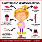 deglución Atípica